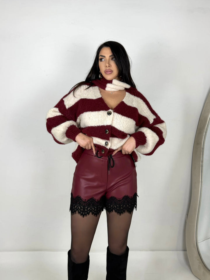 Pantaloncini in eco pelle con dettaglio in pizzo “Anita”